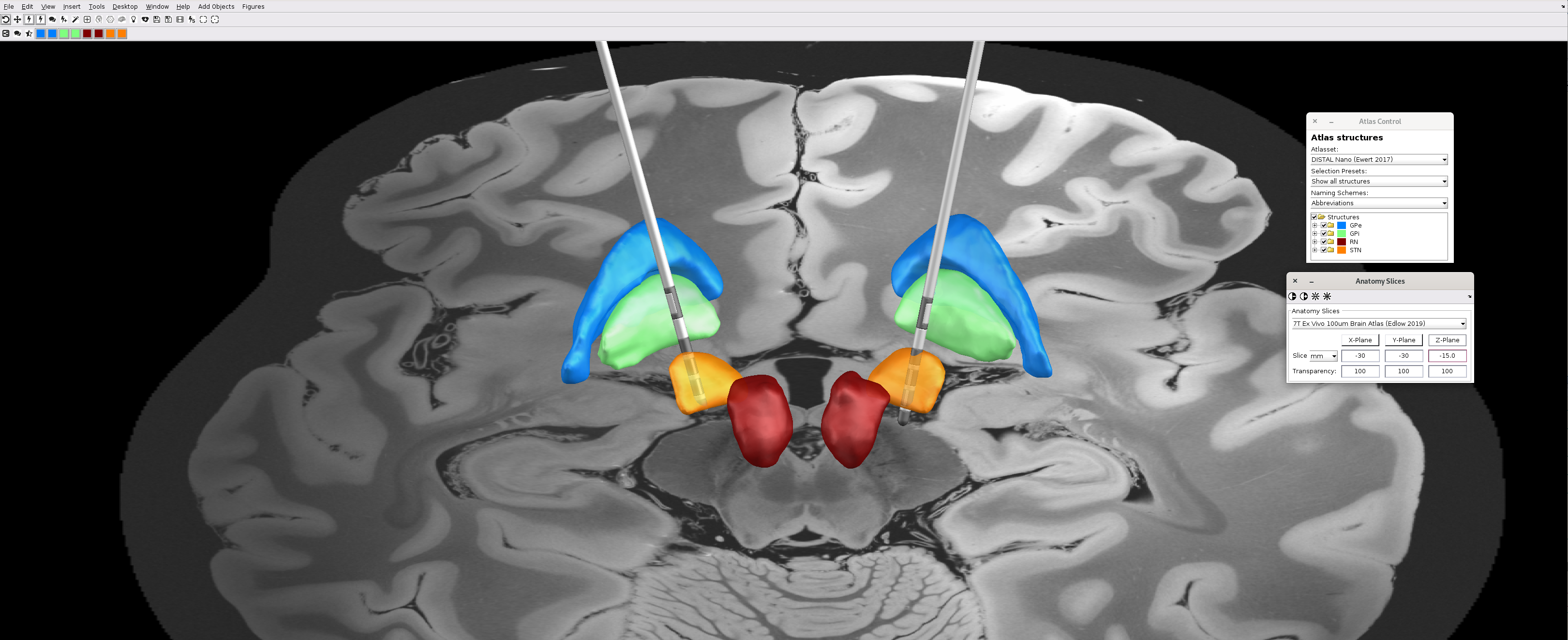 Image3. Lead-DBS 3D Viewer with Atlas Control and Slice Control panels on the right.