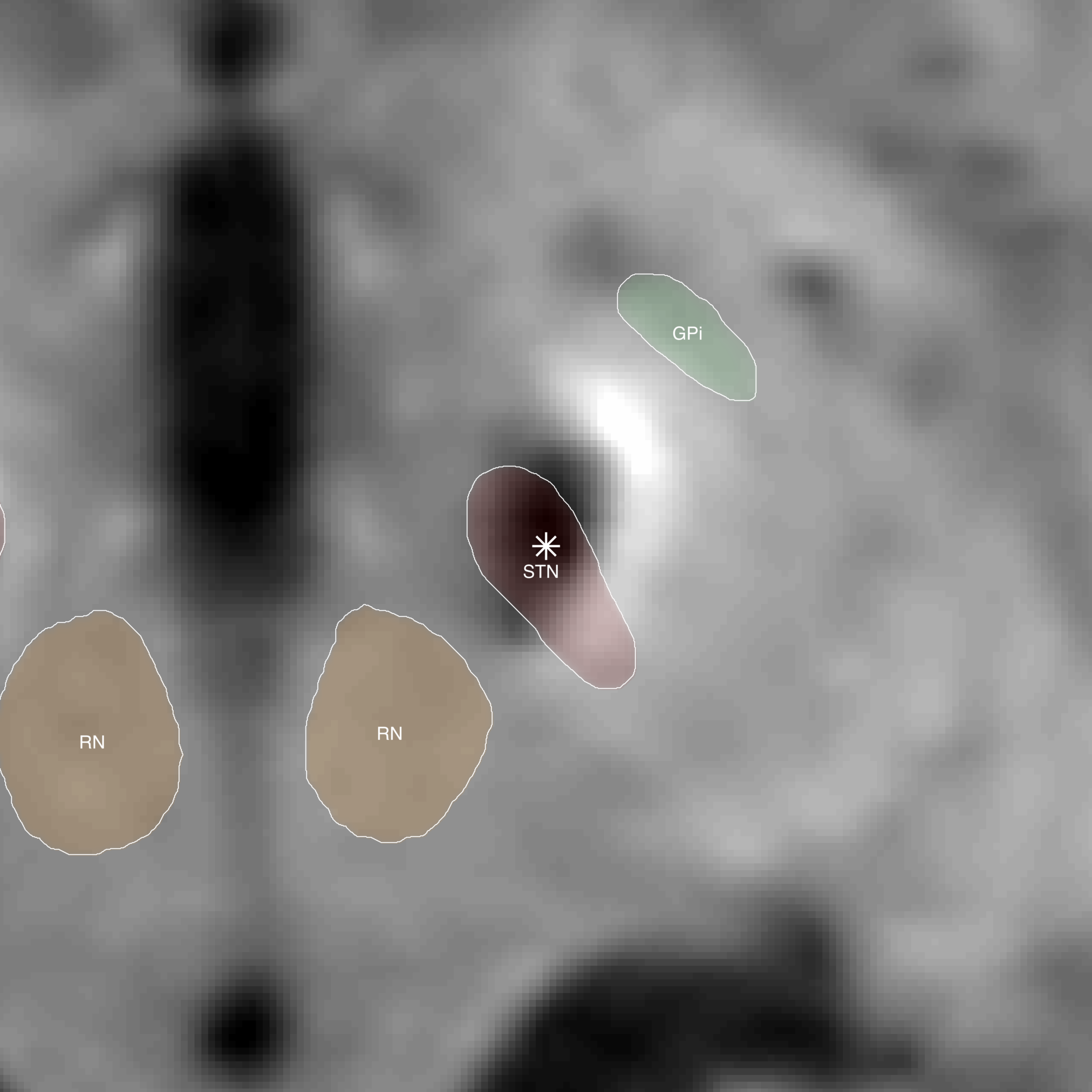 Image 2. 2D Export contact k1 on the right.